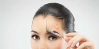 Trądzik u osób dorosłych – jak z nim walczyć? trądzik dorosłych