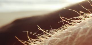 Depilacja laserowa – czy po serii zabiegów wypadają włosy? Odrastanie włosów po depilacji