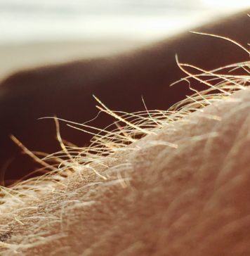 Depilacja laserowa – czy po serii zabiegów wypadają włosy? Odrastanie włosów po depilacji