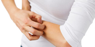 Czym jest egzema dłoni? Jak ją leczyć? kobieta chorująca na egzemę drapiąca się po rękach