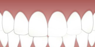 Wybielanie zębów lampą – co warto wiedzieć? grafika przedstawiająca zęby