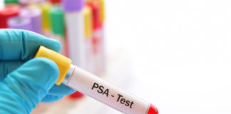Diagnostyka łagodnego rozrostu prostaty próbka krwi do badania PSA