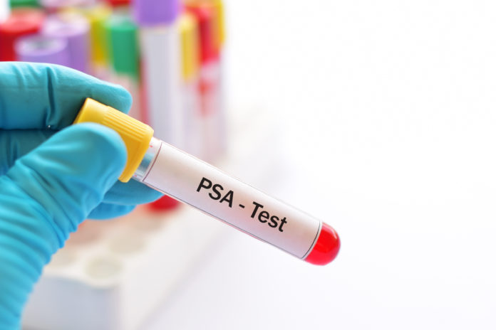 próbka krwi do badania PSA