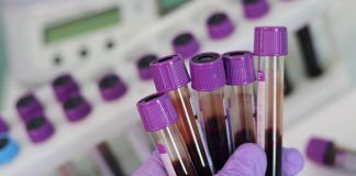 O czym świadczy niski poziom hematokrytów w badaniu krwi? mofrologia