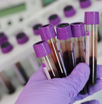 O czym świadczy niski poziom hematokrytów w badaniu krwi? mofrologia