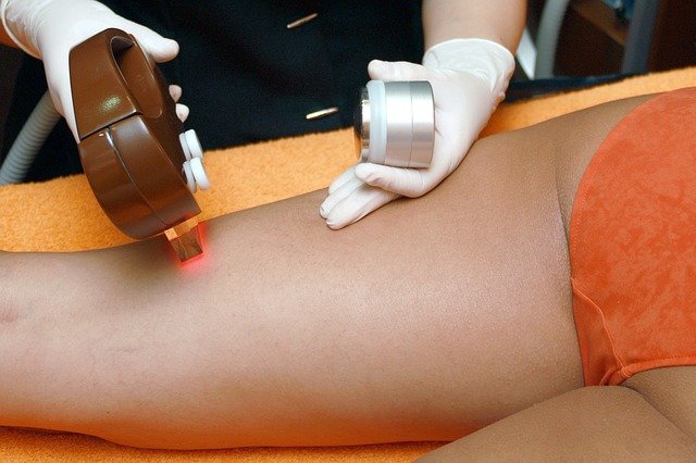 laserowe usuwanie owłosienia laserowe usuwanie owłosienia
