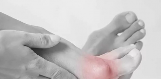 Paluch sztywny – przyczyny, objawy, leczenie paluch sztywny
