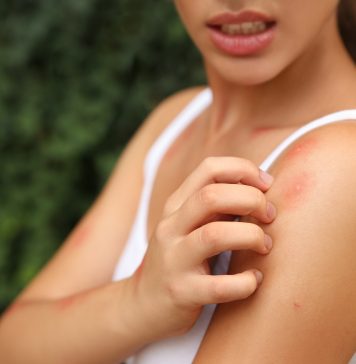 Po co apteczka na wyjazd? ugryzienie owada leki