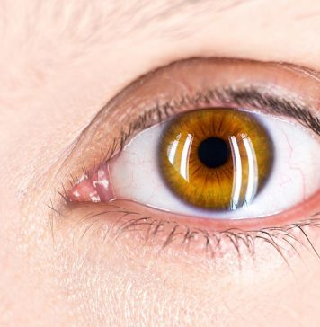 Astygmatyzm – co to jest i jakie są jego objawy? astygmatyzm